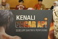 Tim Satgas Imunisasi Dewasa Tekankan Pentingnya Vaksinasi Cacar Api