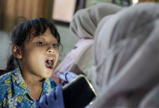 Perkuat Kesehatan Anak, Pemerintah Fokus Tangani Gigi Berlubang lewat CKG