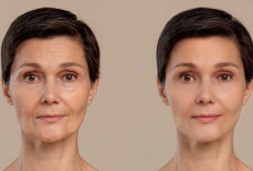 7 Cara Alami Cegah Penuaan Dini agar Kulit Tetap Kencang & Terawat