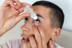 Mata Merah? Ini Penyebab dan 4 Cara Efektif Mengatasinya