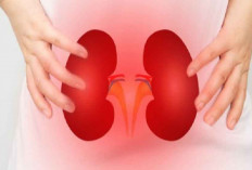 Mengenal Retrograde Intrarenal Surgery, Metode Pengobatan Batu Ginjal Tanpa Operasi