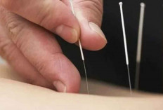 Terapi Rehabilitasi Pasien Stroke dengan Metode Akupuntur