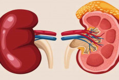 Sering Dikira Sama, Ketahui Perbedaan Antara Batu Ginjal dan Kencing Batu